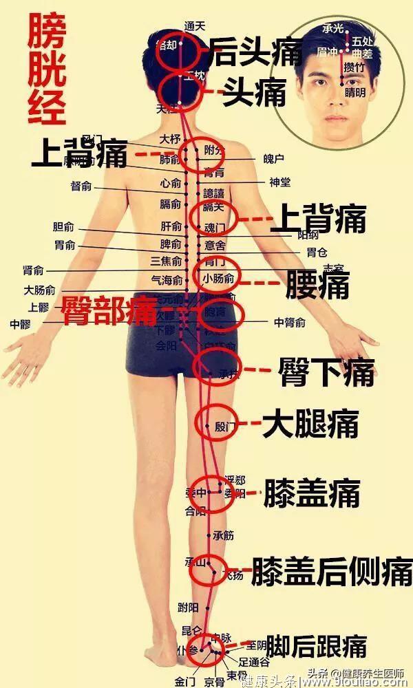 6大经络所过的位置高清图，看完你也懂经络并会治疗疼痛。