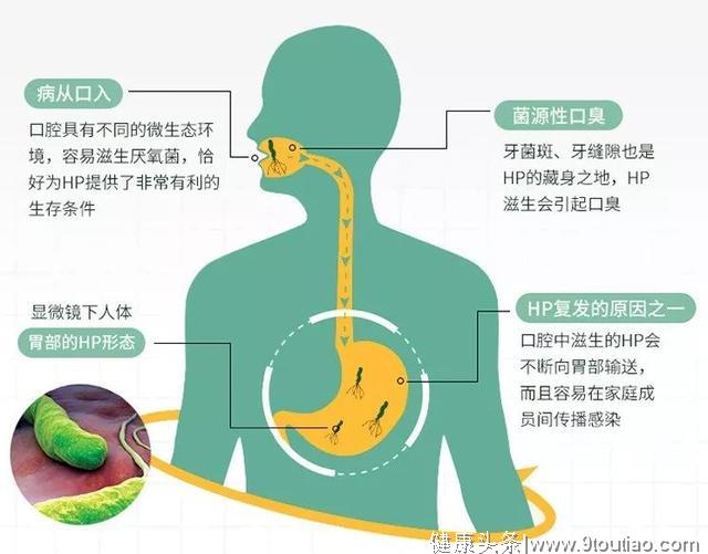 这支获奖无数的牙膏，把幽门螺旋杆菌杀死在口腔里，从此远离胃病