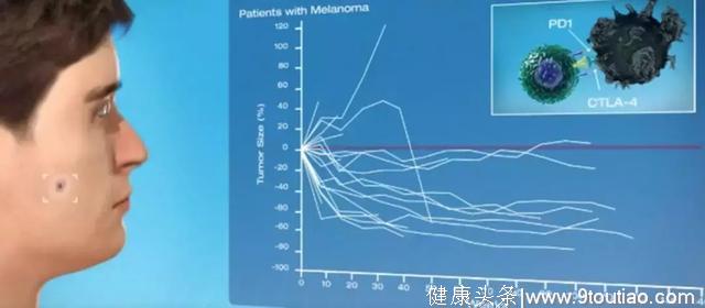 干货|2019，中国癌症患者需要知道的PD-1/PD-L1用药信息大盘点！