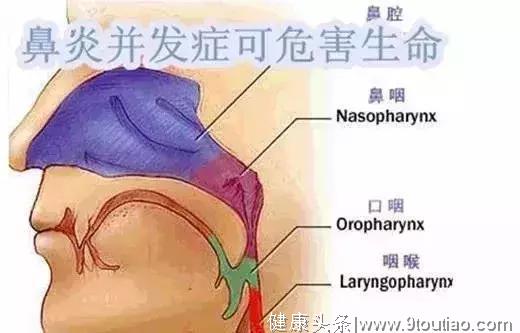 鼻炎会发展成鼻咽癌？耳鼻喉专家：教你4招，轻松摆脱鼻炎困扰!