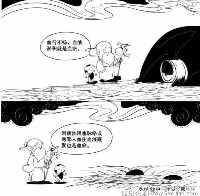 “血运失常”与特发性间质性肺炎