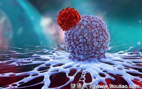 胰腺癌的生存率和如何生存率