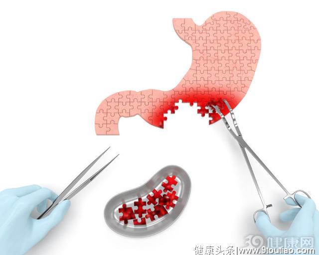 胃癌会有4个标志，出现几个以上，应该尽早到医院检查