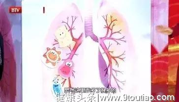 早期肺癌的第一个高危信号，太容易被忽视！一定要当心这类咳嗽