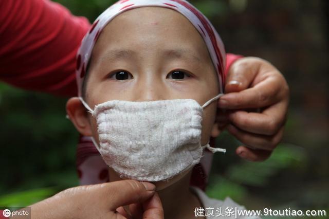 有3样东西是甲醛的高释放源，也是白血病帮手，几乎家家都有