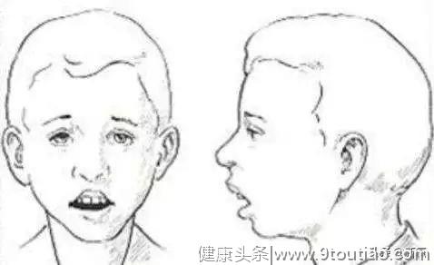 终于找到刘亦菲鼻子如此完美的秘密！鼻炎脸才是毁容于无形啊！