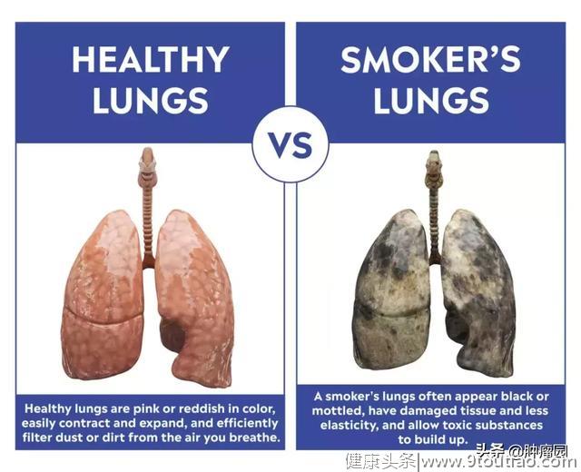预防肺癌，你应该知道这些