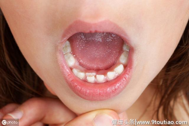 牙齿发黄、口臭？4种方法教你摆脱这种困扰