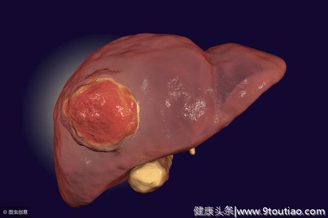 肝癌患者数量为何居高不下？医生：这3种东西才是祸根，尽早远离