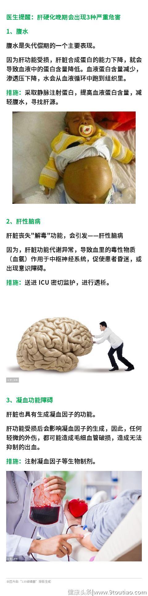 医生提醒：不喝酒也会肝硬化晚期，为了健康，这2件事别再做了！