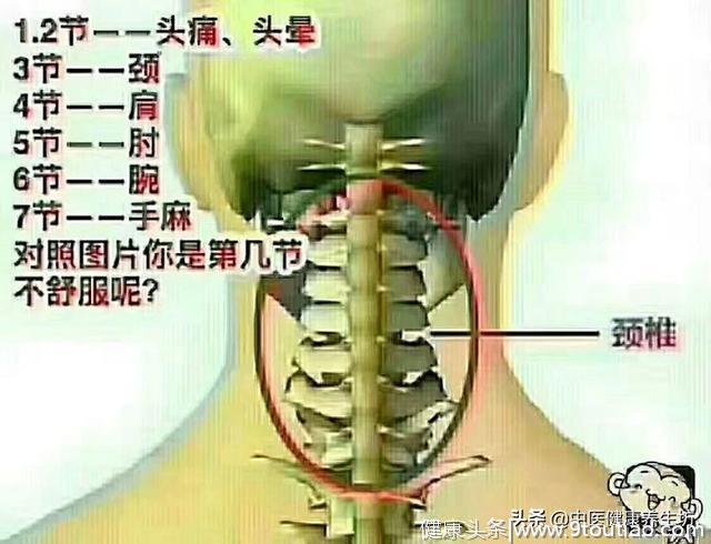 颈椎病会给你带来哪些危害？现在知道还不晚！赶紧看看吧！