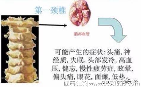 颈椎病会给你带来哪些危害？现在知道还不晚！赶紧看看吧！