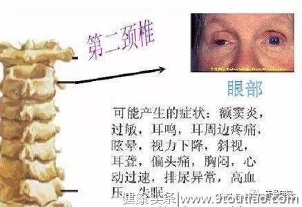 颈椎病会给你带来哪些危害？现在知道还不晚！赶紧看看吧！