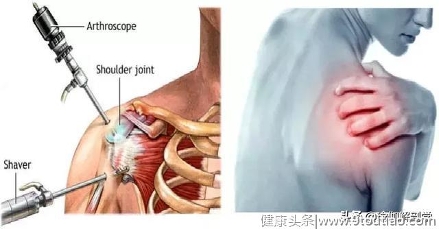 最能减脂塑形的10个瑜伽体式