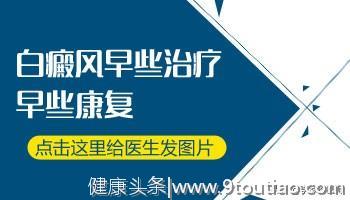 有白癜风就要被定为单身狗吗？我不要