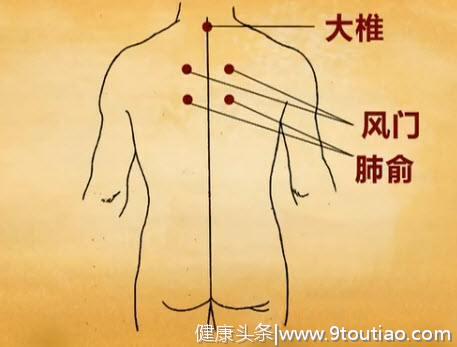 风门穴是感冒的克星 感冒一定要按