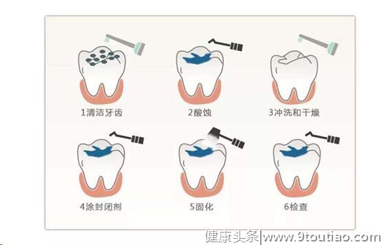 儿童龋齿预防早知道，让孩子拥有一副天生好牙