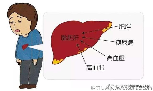 治疗脂肪肝只要牢记这3点，其实治疗也很简单！