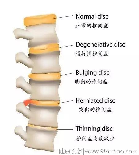 练瑜伽可以长高？