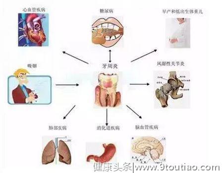 50岁的贾先生牙齿剧烈疼痛，原因公布竟然是吸烟导致