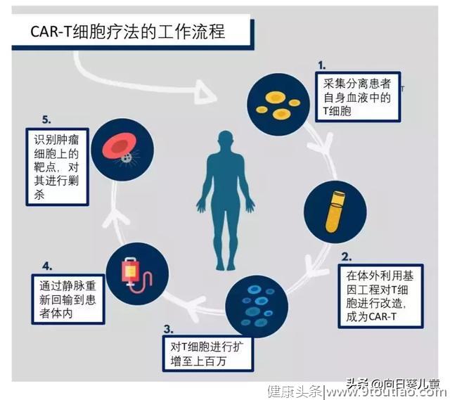 83%的患者肿瘤细胞完全消除，CAR-T疗法迎来白血病治疗新篇章