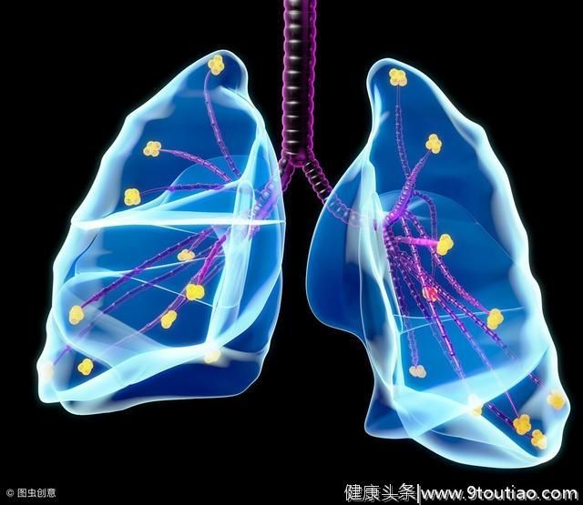 “肺纹路增粗”是肺癌早期吗？发现早期肺癌最有效的手段是什么？