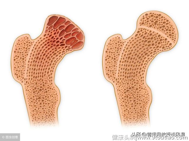 几招教你减少类风湿关节炎药物副作用