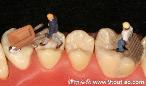 有坏牙在家自己补？DIY补牙！补牙呢！严肃点！