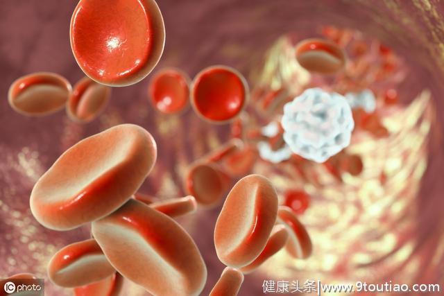 糖尿病人血红细胞大量异常，可能是引起各种并发症的重要原因！