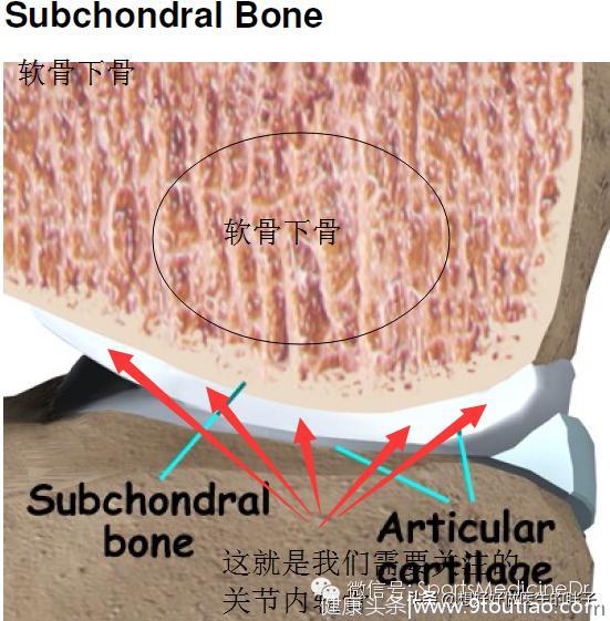 老年人膝关节疼痛的罪魁祸首-骨关节炎！谢医生带您了解膝关节二