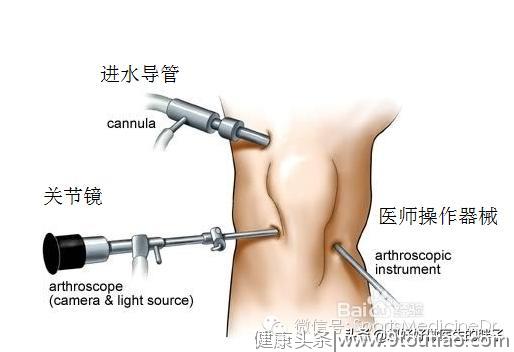 老年人膝关节疼痛的罪魁祸首-骨关节炎！谢医生带您了解膝关节二