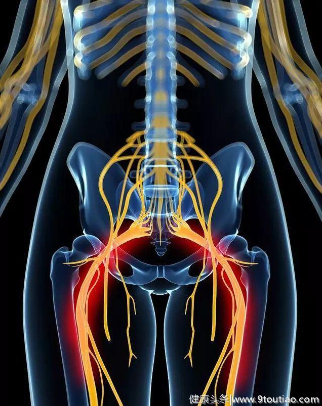 你的屁股疼痛 原来是坐骨神经的问题  针灸推拿效果非常好