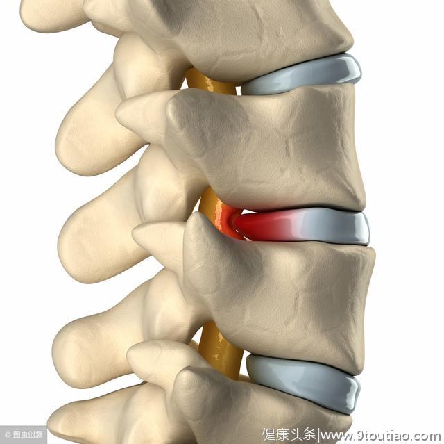 你的屁股疼痛 原来是坐骨神经的问题  针灸推拿效果非常好