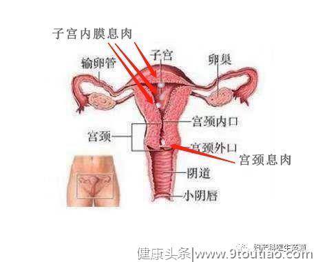 “子宫长息肉”了怎么办？会不会影响怀宝宝？