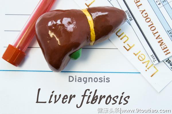 脂肪肝是怎么患上的？离不开这5点原因！肝炎患者更要看看