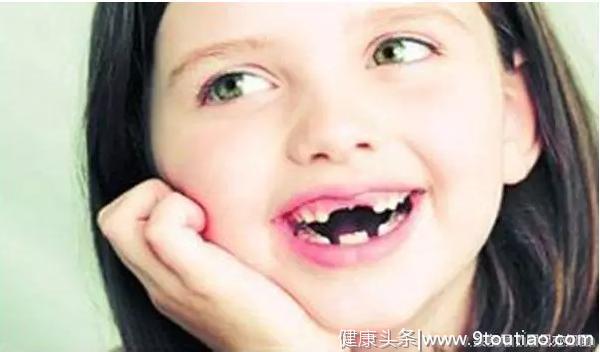 儿童口腔健康问题，90%的中国家长不合格