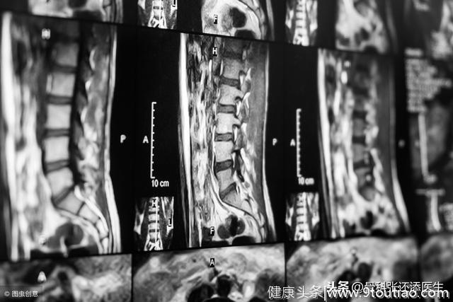 X光，CT，MRI，B超有什么区别？颈椎疼，医生该给我做哪个检查？