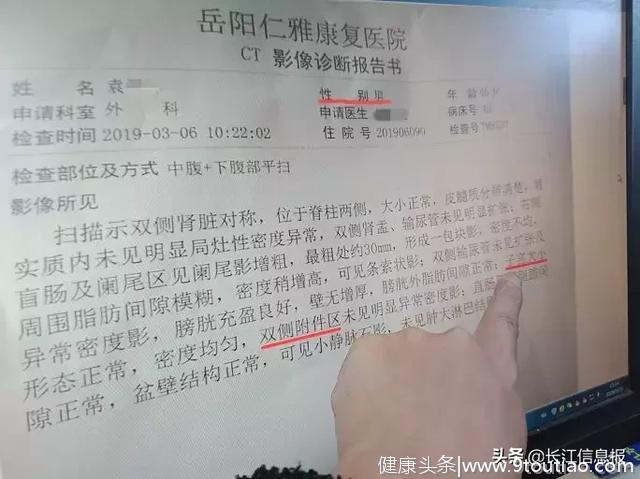 哈哈！岳阳一大老爷们医院做CT，竟检查出“子宫及附件”