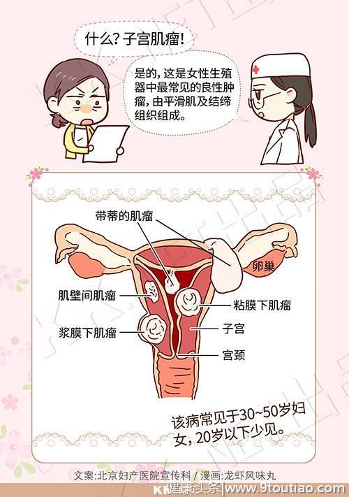 妇科子宫肌瘤