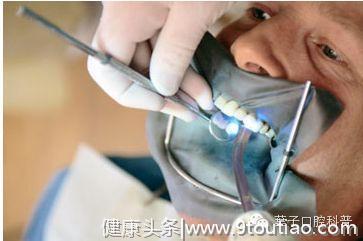 有蛀牙的人必看：一颗蛀牙被牙医拯救的过程（多图，易懂）