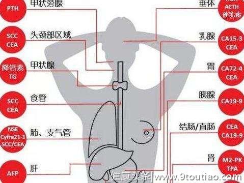 癌症体检怎么做？医生指出：掌握4个原则癌症无处可逃