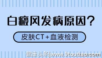 查白癜风你有试过这种方法？专家推荐“三维皮肤ct”