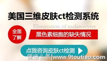 查白癜风你有试过这种方法？专家推荐“三维皮肤ct”