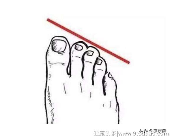 心理测试：你哪个脚趾最长？测你十年后生活水平，我还不如现在！