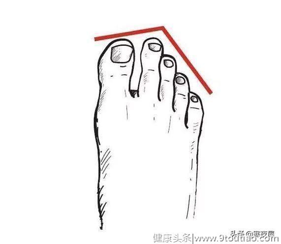 心理测试：你哪个脚趾最长？测你十年后生活水平，我还不如现在！
