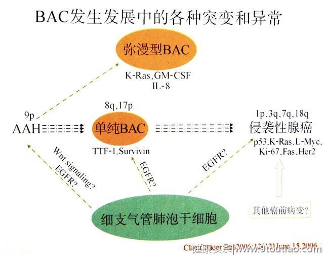 5年生存率达100％的早期微小肺癌却极易误诊为炎性结节？