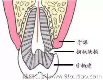 你这样刷牙，当心把牙齿刷断