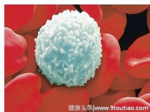 急性粒细胞白血病-M5，采用纯中药治疗病例分享