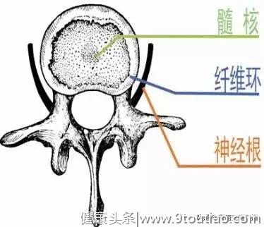 “这哪是23岁的腰”瑜伽教练严重椎间盘突出!这项运动不是人人都能练