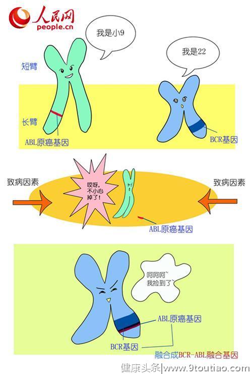 从染色体、基因说起 带你了解“慢性粒细胞白血病”